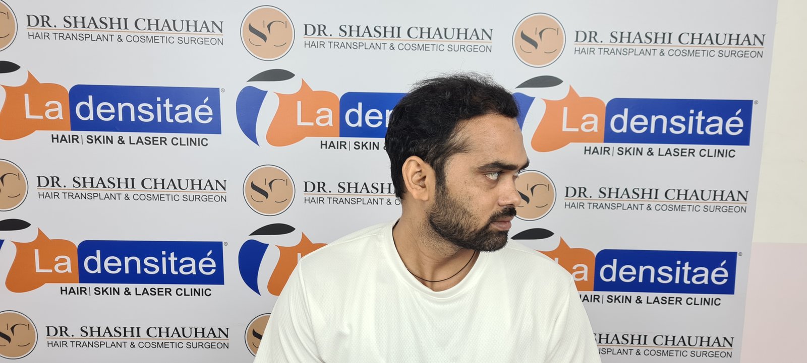 Anesh Kumar After Hair Transplant